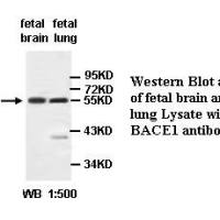 BACE1 Antibody
