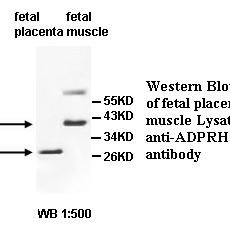 ADPRHL1 Antibody