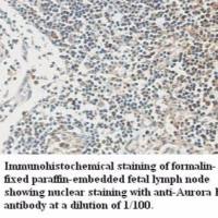 Aurora B Antibody