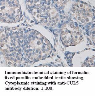 CUL5 Antibody