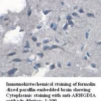 ARHGDIA Antibody