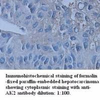 AK2 Antibody