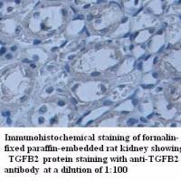 TGFB2 Antibody