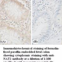 NAT2 Antibody