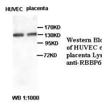 RBBP6 Antibody