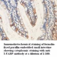 I-FABP Antibody