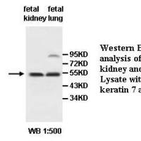 keratin 7 Antibody
