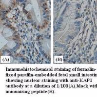 KAP1 Antibody