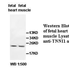 TNNI1 Antibody