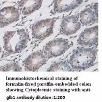 GLB1 Antibody