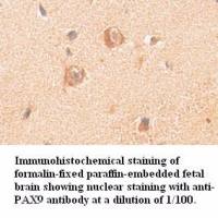 PAX9 Antibody