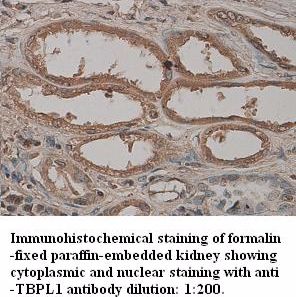 TBPL1 Antibody