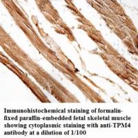 TPM4 Antibody