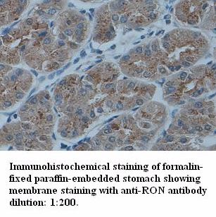 RON Antibody