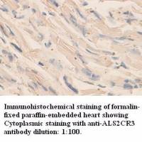 ALS2CR3 Antibody