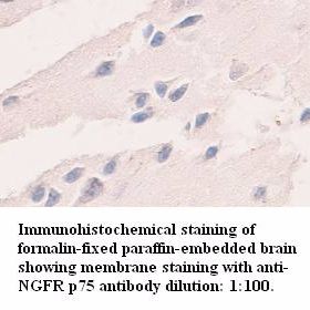 NGFR p75 Antibody