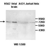 CD2AP Antibody