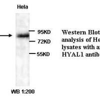 HYAL1 Antibody