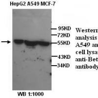 Beta tubulin Antibody