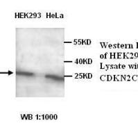 CDKN2C Antibody