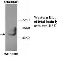 NSE Antibody