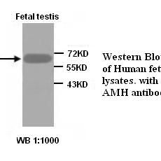 AMH  Antibody