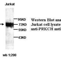 PRKCH Antibody