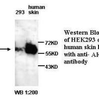 AKT2 Antibody