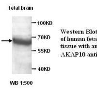 AKAP10 Antibody