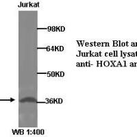 HOXA1 Antibody