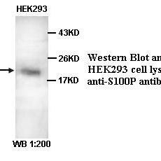 S100P Antibody