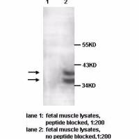 PARP11 Antibody