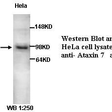 Ataxin 7 Antibody