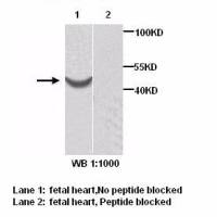 ACTR1B Antibody