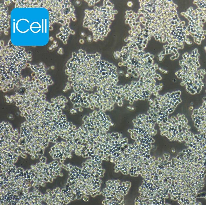 COLO320 人结肠腺癌细胞/STR鉴定/镜像绮点(Cellverse)