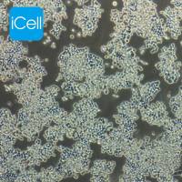 COLO320 人结肠腺癌细胞/STR鉴定/镜像绮点(Cellverse)