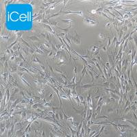 HPASMC 人肺动脉平滑肌细胞/STR鉴定