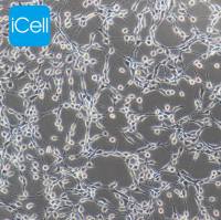 NIH/3T3/U87MG/WSU-HN6/NU-DUL-1/KYSE-450/STR鉴定