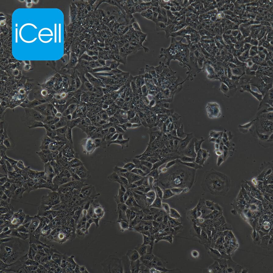 DLD-1 人结直肠腺癌上皮细胞/STR鉴定/镜像绮点（Cellverse）