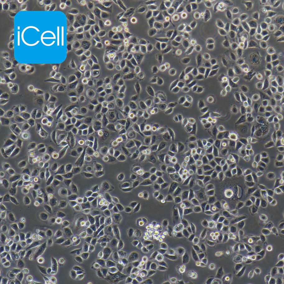 AsPC1 人转移胰腺腺癌细胞/STR鉴定/镜像绮点（Cellverse）