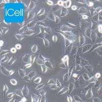 HPAC 人胰腺癌细胞/STR鉴定/镜像绮点（Cellverse）