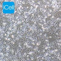 HLE细胞 | HLE细胞 | HLE | 人肝癌细胞（未分化）| STR鉴定 | 镜像绮点