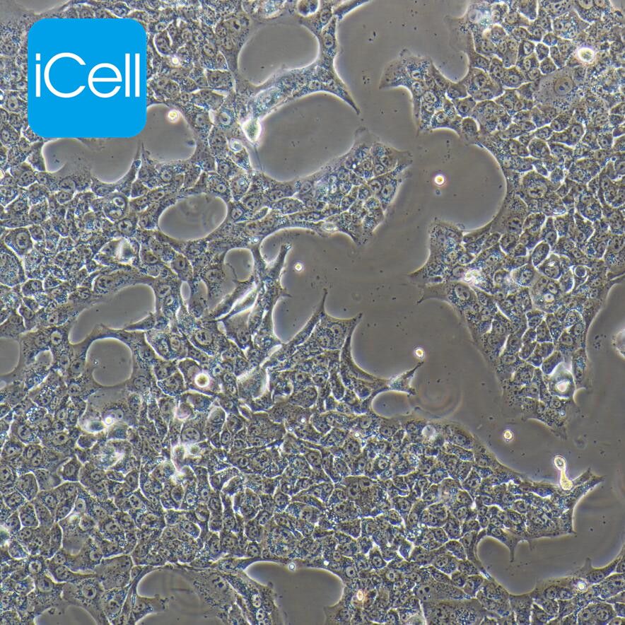 HCC827 人非小细胞肺癌细胞/STR鉴定