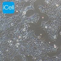 HCC827、HCC827细胞、HCC-827细胞、HCC-827、人非小细胞肺癌细胞/STR鉴定