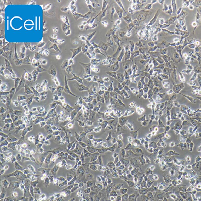MUM-2B 人侵袭性脉络膜黑色素瘤细胞/STR鉴定/赛百慷（iCell）