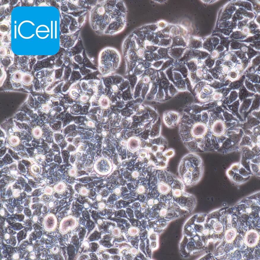 JEG-3 人绒毛膜癌细胞/STR鉴定/镜像绮点（Cellverse）