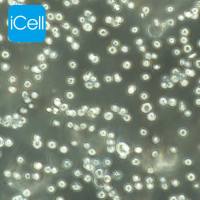 NCI-H929 人骨髓瘤细胞/STR鉴定/镜像绮点(Cellverse)