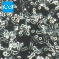 MIA-PACA-2细胞、MIAPACA2细胞、MIA-PACA-2、人胰腺癌细胞/STR鉴定/镜像绮点(Cellverse)