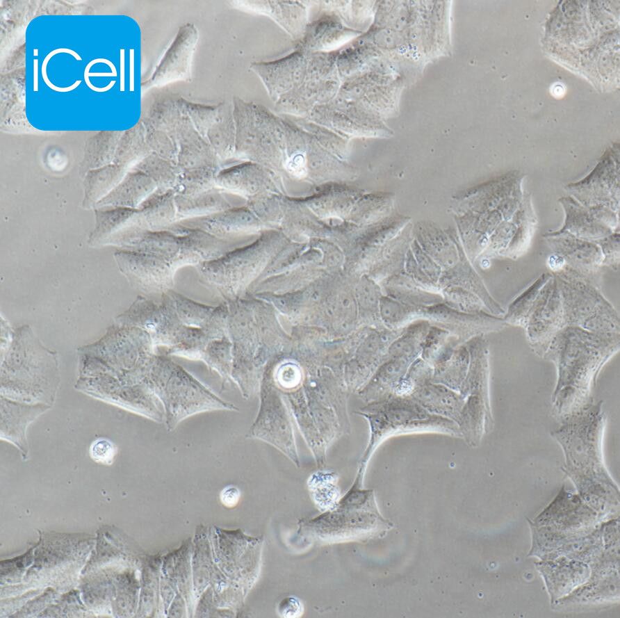 MDA-MB-361、MDA-MB-361细胞、MDAMB361细胞、MDAMB361、人乳腺癌细胞/STR鉴定/镜像绮点(Cellverse)