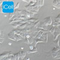 MDA-MB-361、MDA-MB-361细胞、MDAMB361细胞、MDAMB361、人乳